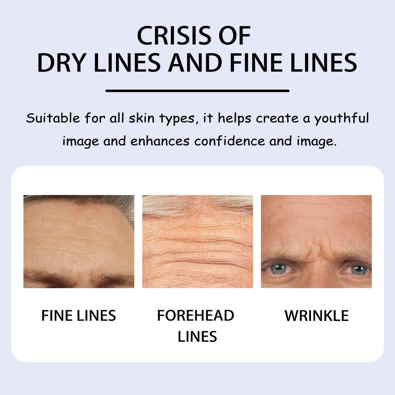 Forehead Mask, Smoothing Sichuan Character Lines And Raising Head Lines Mask Lighten Wrinkles Firming Skin Gel Forehead Patch