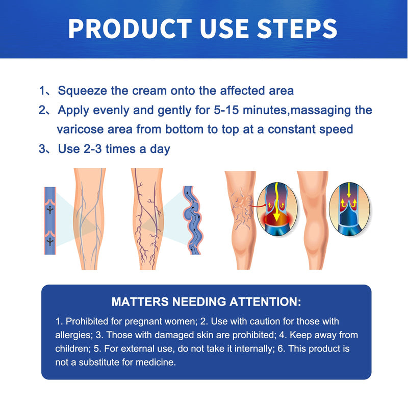 South Moon Vein Massage Varicose Cream Repair Earthworm Legs To Relieve Leg Blood Vessel Bulge And Varicoidea