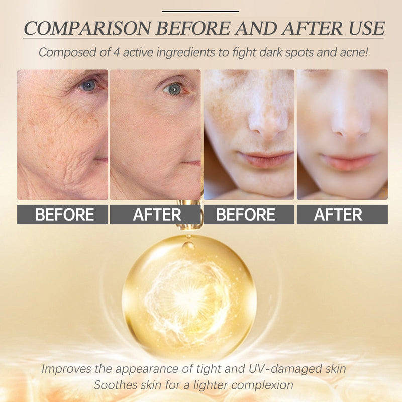 Retinol Essence, Firming Fine Lines And Lightening Melasma Moisturizing Anti-Wrinkle Essence