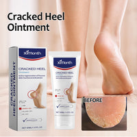 Cracked Heel Ointment, Repair Heel Calluses And Foot Moisturizing Anti-Cracking Peeling Care