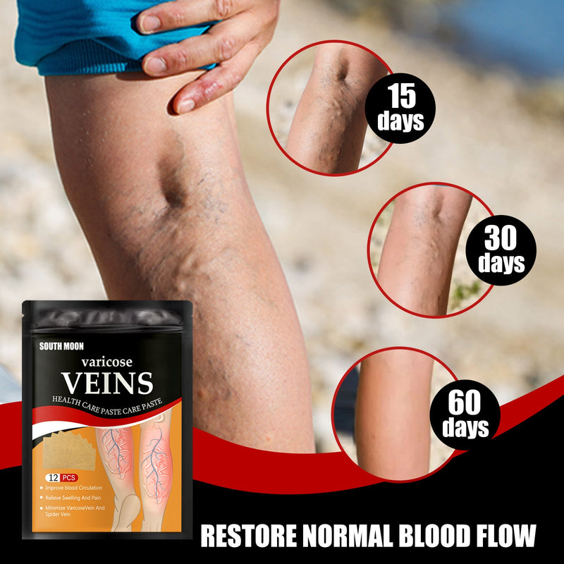 Foot Vein Patch, Relieve Varicose Blood Vessel Blockage And Protrusion Cold Compress Venous Health Care Patch