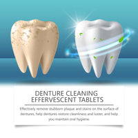 Oralhoe Denture Cleaning Tablet Clean Care Fresh Stain Removal Gentle Care Braces Denture Cleaning Tablet