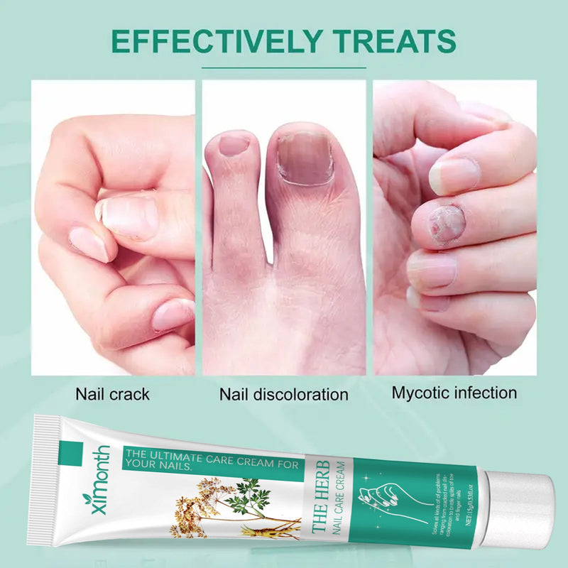 Nail Repair Cream Repair Grey Nails, Soft Nails, Thickening Nails, Pain Relief Nail Care Cream