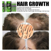 Hair Growth Serums, Hair Anti-Drop Liquid Hairline Thick Hair Herbal Essential Oil