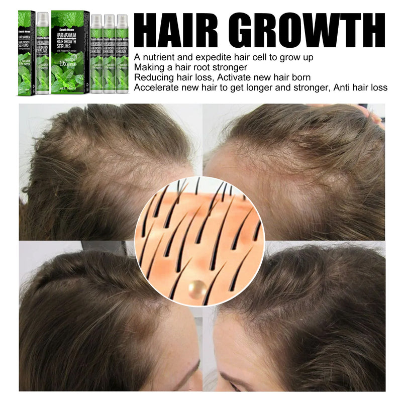 Hair Growth Serums, Hair Anti-Drop Liquid Hairline Thick Hair Herbal Essential Oil