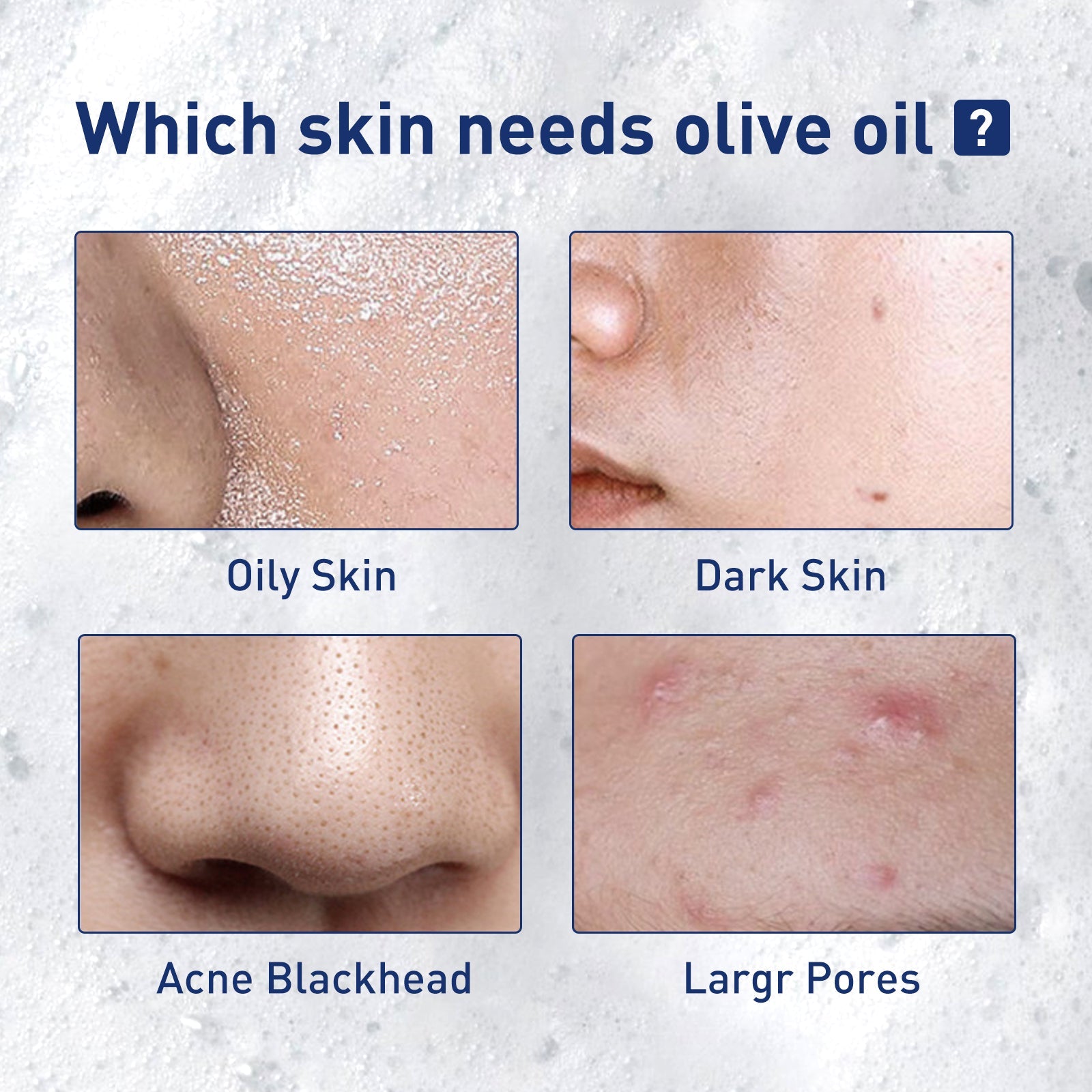 Exfoliating Mousse, Cleanser Skin Pore Control Oil Gently Cleanses Exfoliating Dead Blackheads