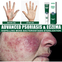 Wet Search Herbal Cream, Skin Cream Moisturizes, Hydrates And Reduces Itching Herbal Cream