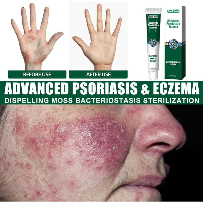 Wet Search Herbal Cream, Skin Cream Moisturizes, Hydrates And Reduces Itching Herbal Cream