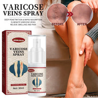 Vein Repair Agent Varicose Massage Relieves Earthworm Leg Repair Soreness And Swelling Body Care