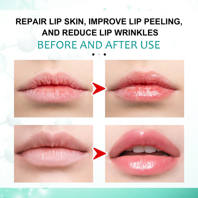 Repair Lip Liquid Dressing, Lip Dressing To Reduce Lip Lines And Reduce Dead Lip Skin Care
