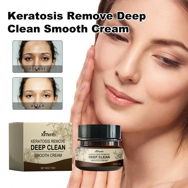 Keratosis Remove Deep Clean Smooth Cream, Clear Skin Acne Exfoliating Unclog Pores Moisturizing Tender And Smooth Skin