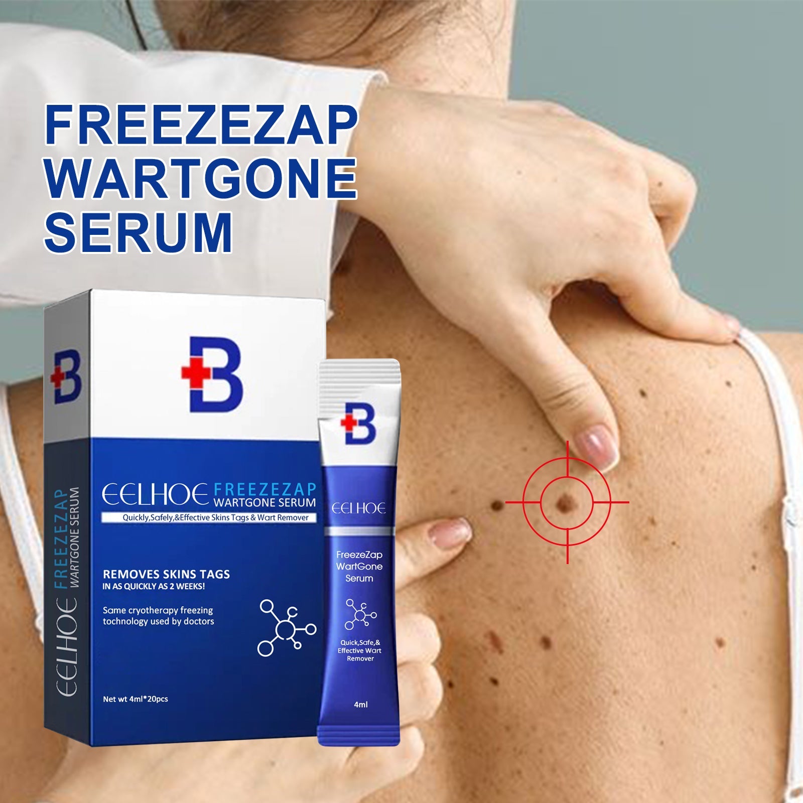 ke Wart Essence, Repair Moles, Flesh Granules, Flatness, Especially Clear Skin Body Skin Care