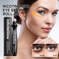 Nicotinamide Eye Cream Reduces Dark Circles And Fine Lines Under Eyes Hydrates And Moisturizes Skin Around Eyes Repairing Eye Cream
