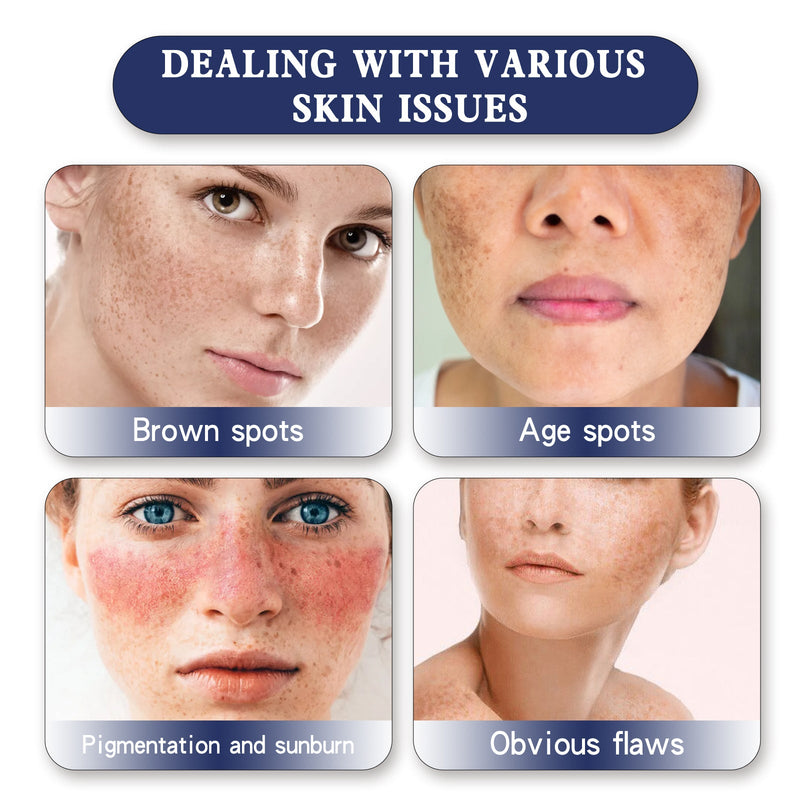 Skin Genesis Spot Whitening Cream, Dilute Spots Smooth Skin Bright White Color This Delicate Skin Moisturizing Cream
