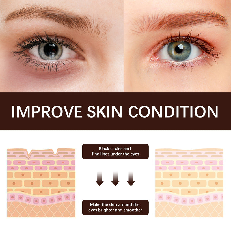 Retinol Eye Cream Firming, Moisturizing, Lifting And Smoothing Fine Lines Crow's Feet Anti-wrinkle Eye Cream