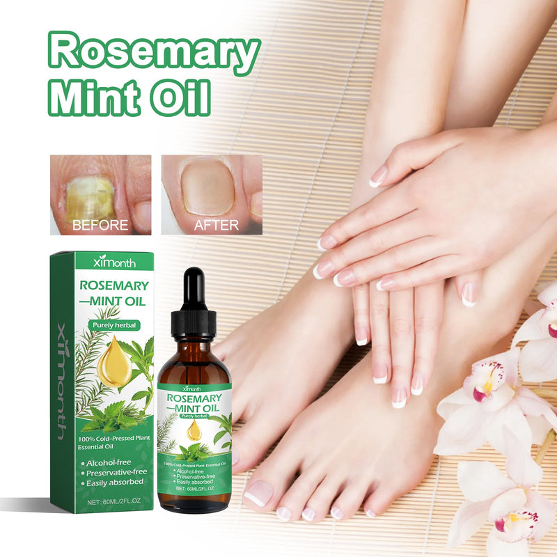 Rosemary Mint Oil, Hair Thickening, Hair Strengthening, Hand, Foot And Nail Care Essence
