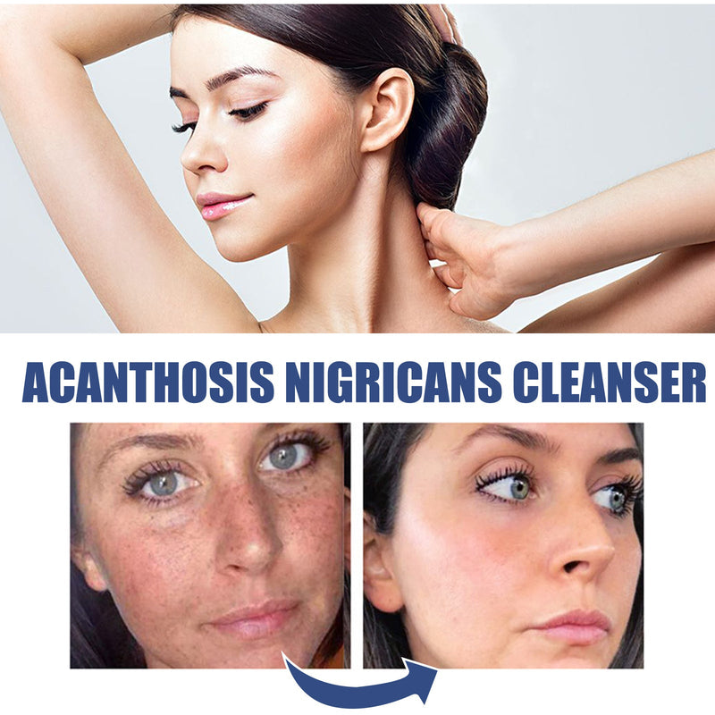 Black Acanthoderm Cleanser Face Deep Clean, Soft And Moisturizing Skin Repair Oil Control Cleansing Cleanser