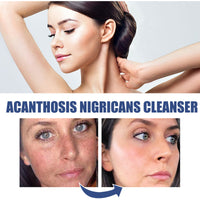 OUHOE Black Acanthoderm Cleanser Face Deep Clean, Soft And Moisturizing Skin Repair Oil Control Cleansing Cleanser