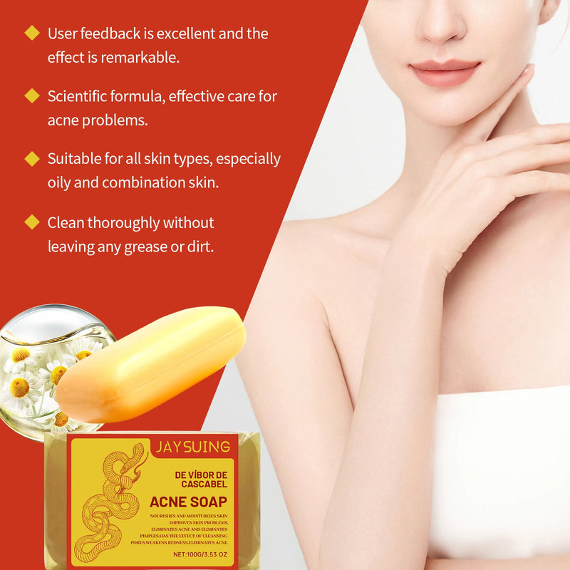Acne Cleansing Soap Gently Cleanses Back Pimples Smooth And Refreshing Cleansing Soap