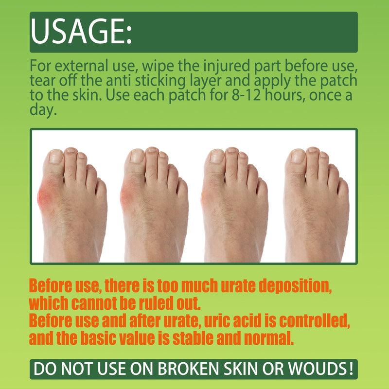 South Moon Gout Patch, Relieve Finger Toe Joint Cervical Vertebra Lumbar Pain Bunion Care Patch
