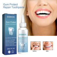 EELHOE Dental Care Toothpaste Cleans The Mouth, Removes Tartar Stains, Yellow Teeth, Brightening Teeth, Care For Teeth