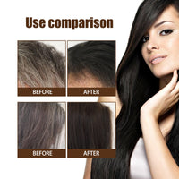 Black Hair Essence Scalp Care Massage Moisturizing Hair And Strengthening Hair Lotion Black Hair Essence