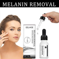 Lightening Spot Serum, Facial Skin Lightening Spot Freckles Dark Yellow Sun Spot Brightening Complexion