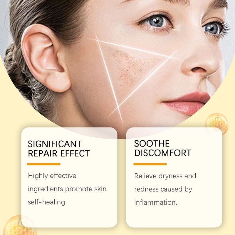 Houkea Bee Venom Skin Care Cream Gently Cleanses And Removes Nevus Moisturizing And Soothing Skin Care Cream