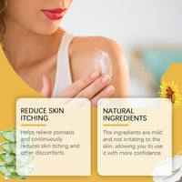 Bee-Venom Cowhide Moss Cream For Itchy Redness, Relieving Itching And Improving Skin Topical Care Cream