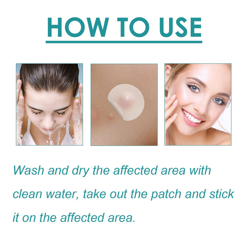 Blemish Treatment Patch, Fade Face Flesh Nevus Cure Warts Clean Body Smooth Skin Repair Corns Cure Warts Patch