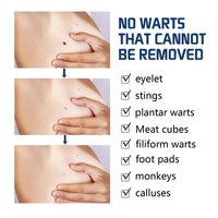 Wart Repair Kit, Skin Tag Remover Hand and Plantar Wart Mole Removal And Repair Lotion Set
