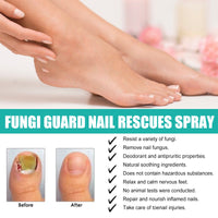 Nail Care Spray Soft Nails Thickening Nails Gray Nails Cleaning Odor Brightening Nails Spray