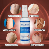 EELHOE Intravenous Massage Spray For Varicose Veins Relief And Earthworm Leg Blood Vessel Bulge Pain Spray
