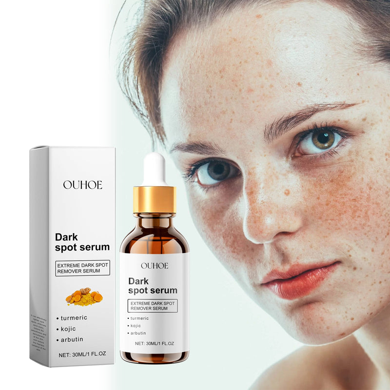 Dark Spot Serum, Hydrating Moist Firming Facial Skin Repair Skin Dark Bright Skin Care Essence