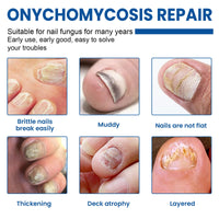 Nail Fungus Patches, Repair Hand And Foot Nails Inlaid Nail Thickening Gray Nail Brightening Nail Patch