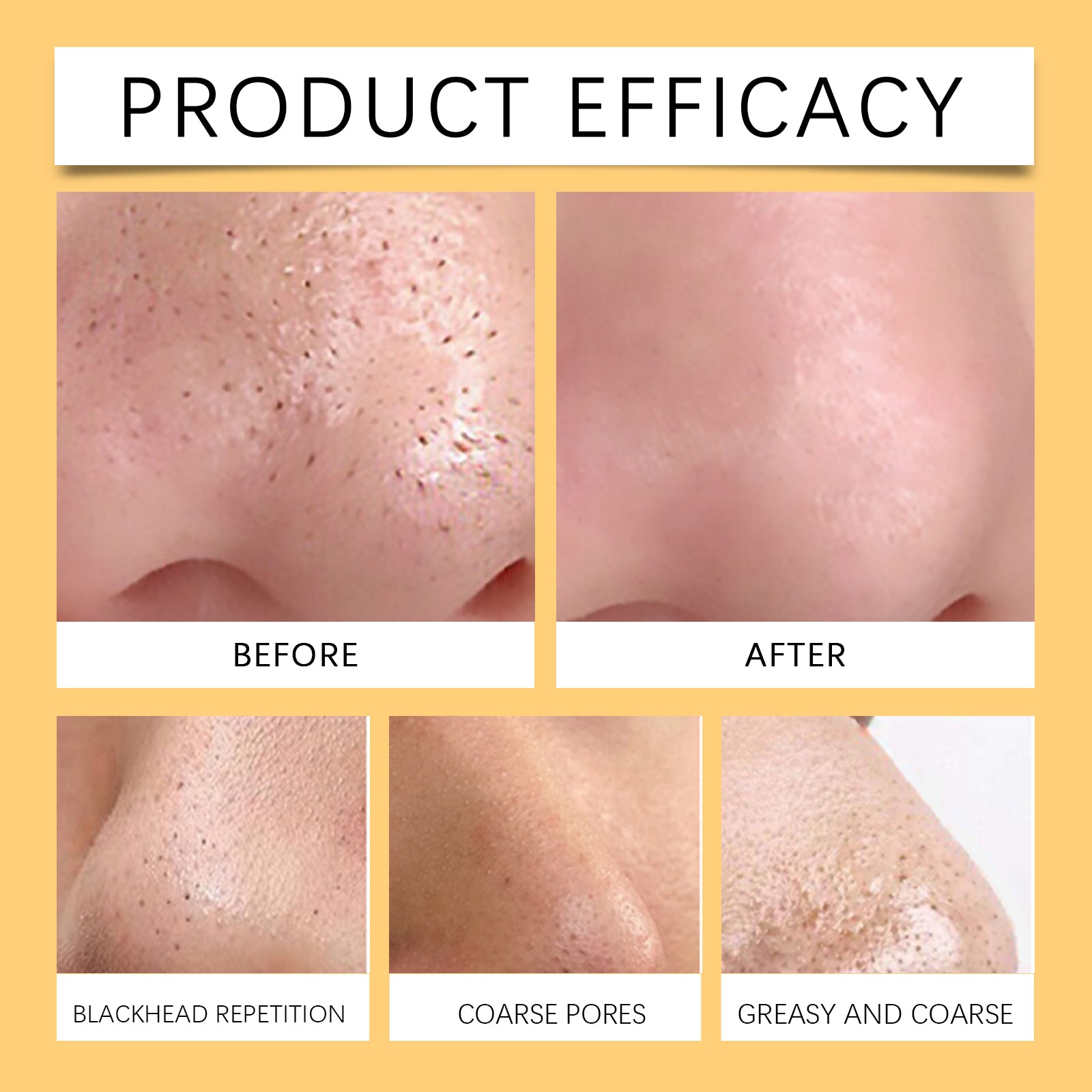Pore Cleansing Patch, Moisturizing Oil Control Remove Blackheads Gently Clean Pores And Moisturize