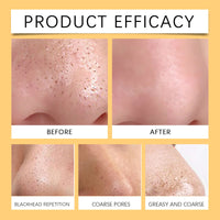 Pore Cleansing Patch, Moisturizing Oil Control Remove Blackheads Gently Clean Pores And Moisturize