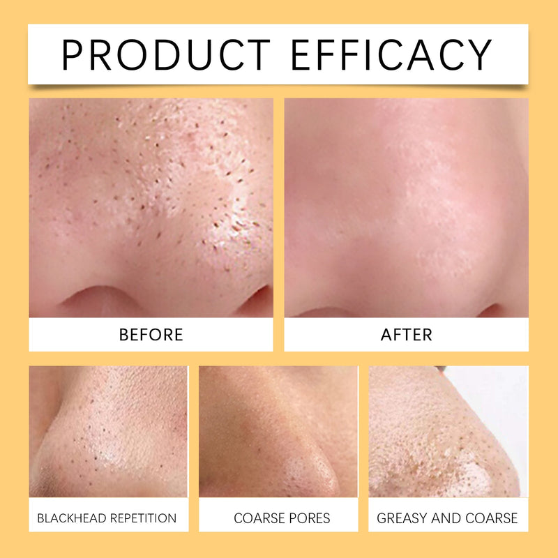 Pore Cleansing Patch, Moisturizing Oil Control Remove Blackheads Gently Clean Pores And Moisturize