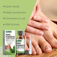 Toenail Repair Set Foot Nail Care Grey Nail Polish Soft Nail Polish Treatment Solution