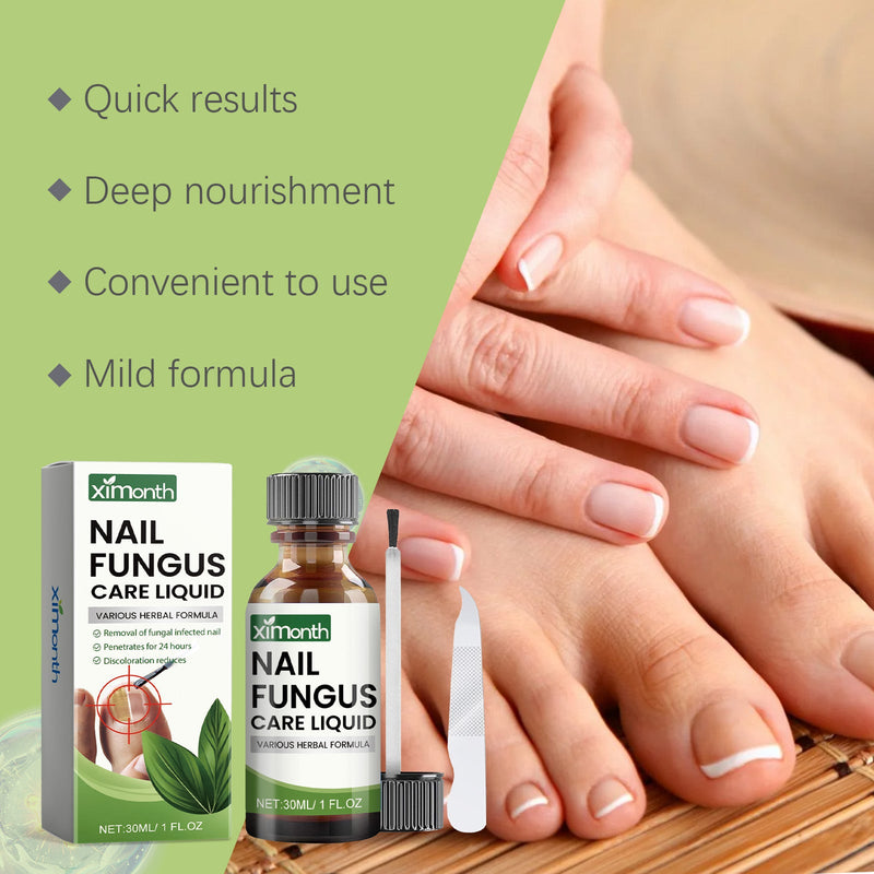 Toenail Repair Set Foot Nail Care Grey Nail Polish Soft Nail Polish Treatment Solution