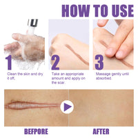 EELHOE Skin Care Cream, Daily Moisturizing, Smoothing And Firming Skin Repair Postpartum Repair Topical Cream
