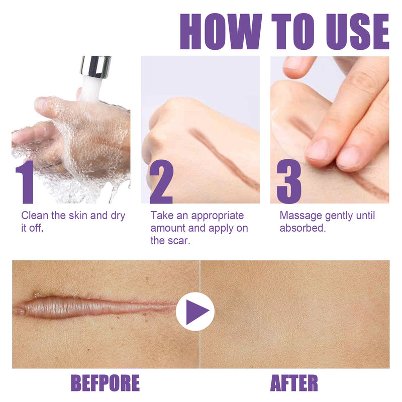 EELHOE Skin Care Cream, Daily Moisturizing, Smoothing And Firming Skin Repair Postpartum Repair Topical Cream