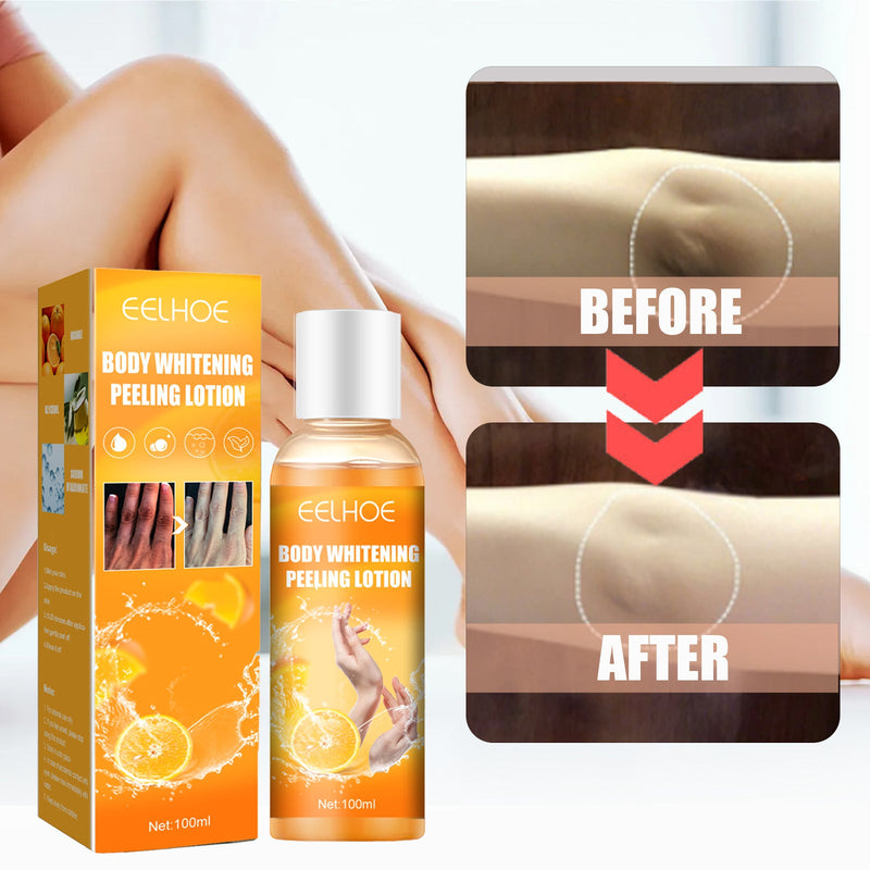 EELHOE Blackening Whitening Gel, Repair Hydrating Brightening Skin Melanin Removal Gel