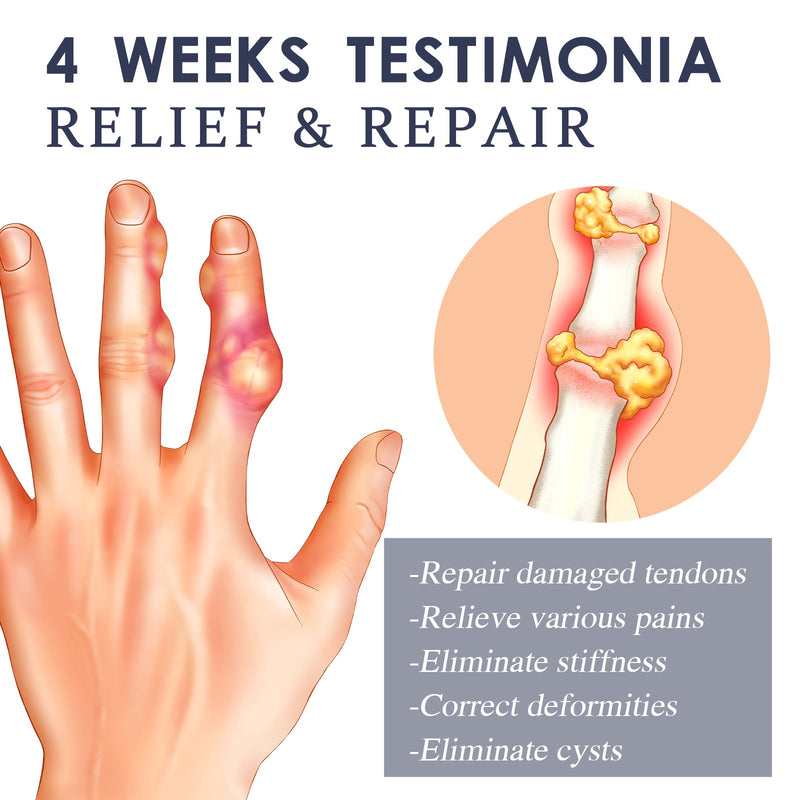Ximonth Bee Venom Joint Spray, Relieves Hands Legs Bones Knees Lumbar Vertebra Sedentary Joint Pain Body Care Spray