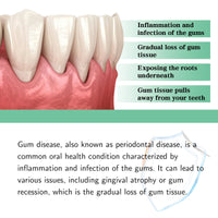 South Moon Gum Care Drops Care For Gums Relieve Bubbling Oral Cleansing Drops