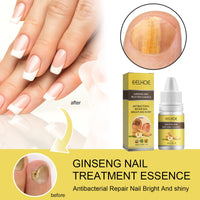 EELHOE Ginseng Nail Essential Oil Grey Nail Thickening Nail Repair Brightening Nail Removing Soft Nail Moisturizing Essence