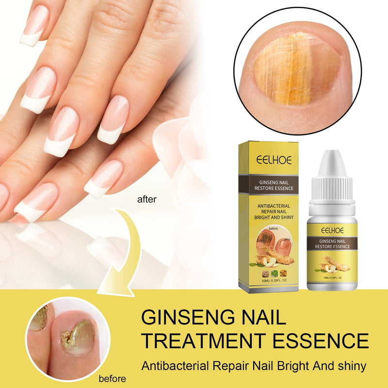EELHOE Ginseng Nail Essential Oil Grey Nail Thickening Nail Repair Brightening Nail Removing Soft Nail Moisturizing Essence