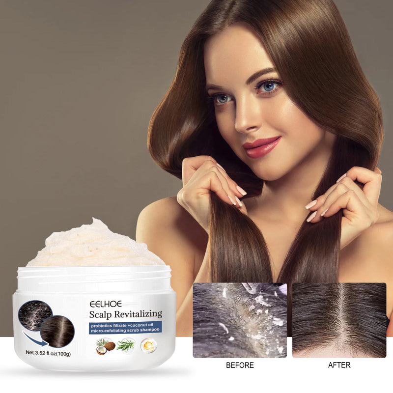 EELHOE Scalp Exfoliating Scrub Moisturizes Dry Hair And Scalp Cleansing Treatment Refreshing Scrub