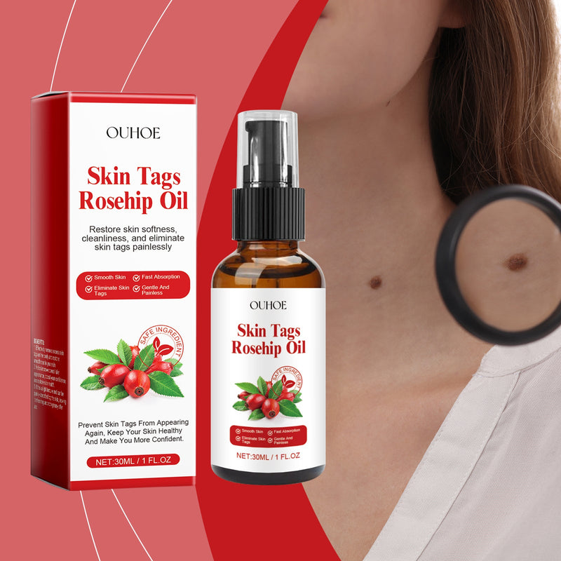 Ouhoe Rosehip Seed Wart Essence Oil Skin Label Repair And Fade Mole Corns Meat Kernel Essence