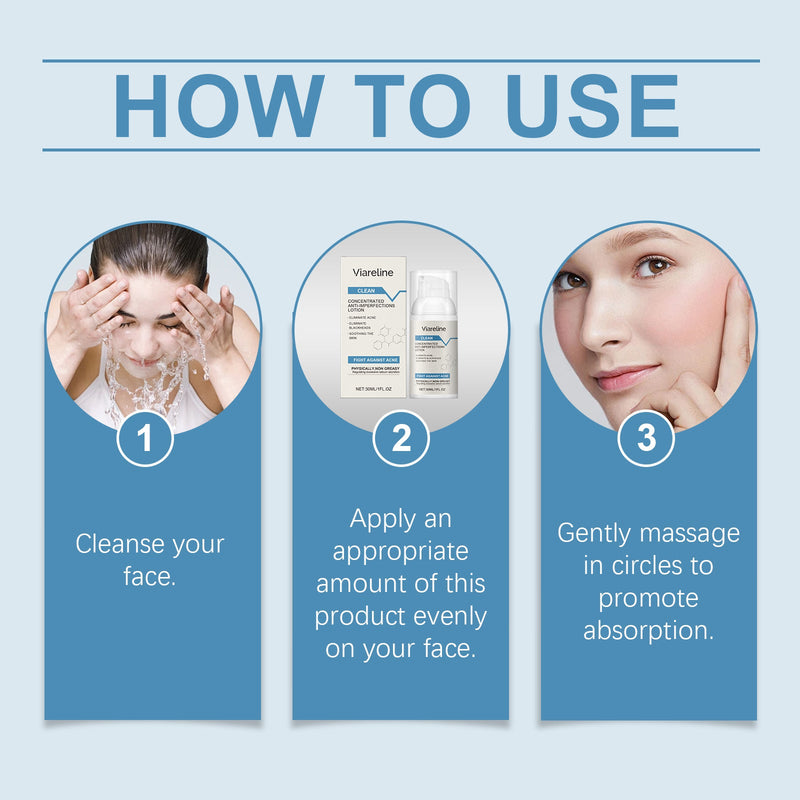 Soothing Anti-Acne Repair Lotion